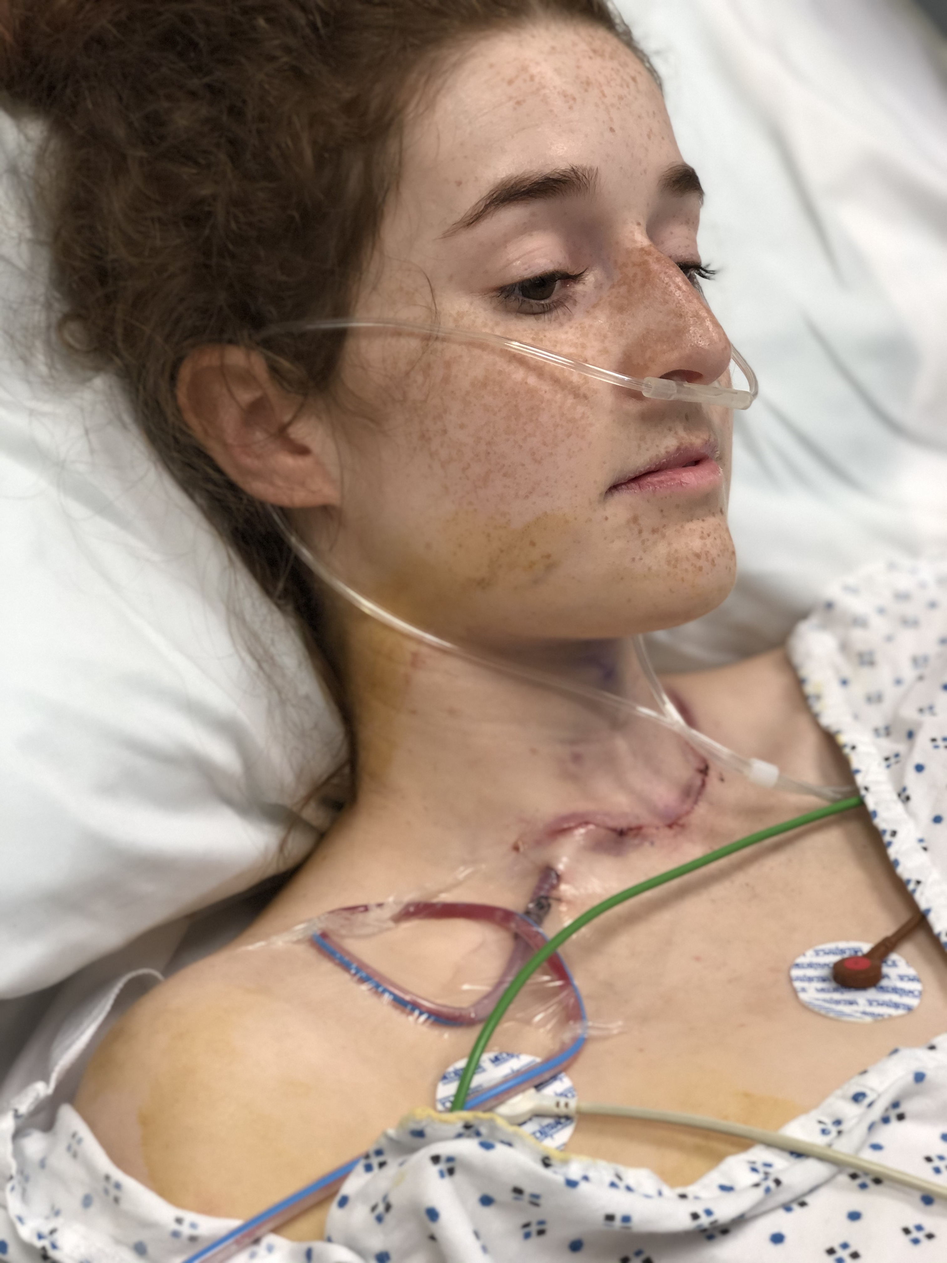 Jemima undergoing thyroid surgery